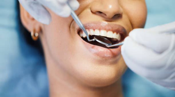 Best Emergency Dental Care for Broken or Chipped Teeth in Cranston, RI